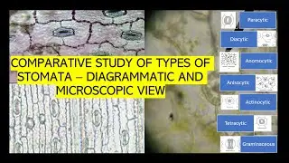 Botanists way to IDENTIFY STOMATAL TYPES UNDER MICROSCOPE | 7 types and differences