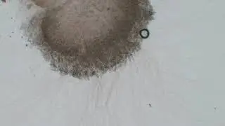 Nematocyst demonstration
