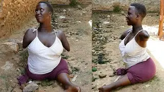 Life Without Limbs : BORN DIFFERENT