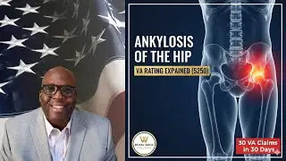 VA Rating for Ankylosis of the Hip Explained (Diagnostic Code 5250)