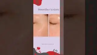 Exuviance - Daily Resurfacing Peel CA10 (36 Pads / 58ml)