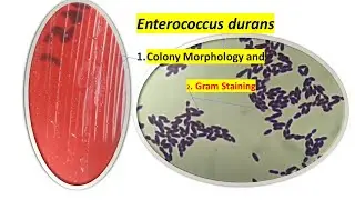 Enterococcus durans Colony Morphology , wet mount and Gram Staining