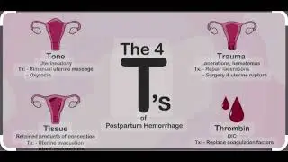 After delivery complications #blood #pph #complication #pregnancyjourney #pregnancytips #pregnancy
