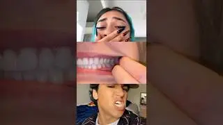 Ваш прикус идеален? 🦷 Вот как это определить