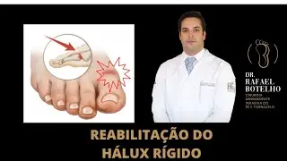 REABILITAÇÃO DO HÁLUX RÍGIDO