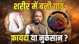 हमारी Body में गांठ क्यों बनाती है? | Cyst/Lump/Tumor का इलाज | HIIMS Hospital | Acharya Manish Ji