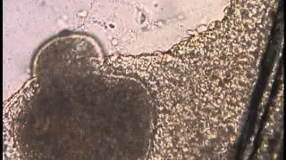 Ichthyophthirius multifiliis.wmv