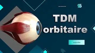 Bonne Pratique en Scanner  _TDM orbitaire _