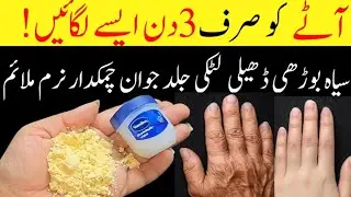 Homemade 0 Cost Skin Whitening Mask | Just one Time Apply all skin problems will be gone forever