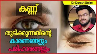 695: 👁 കണ്ണ് തുടിക്കുന്നതിന്റെ കാരണങ്ങളും പരിഹാരങ്ങളും.. Eye twitching Causes and Remedies..
