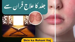 Jild Ki Bemari Ka Ilaj | Quran Se Shifa Ka Wazifa (100% Asar Dar) |  Wazifa for Skin Diseases