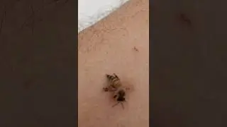 Bee stings 🐝 Apitherapy #bees #beememes #bee #poison #insectsandbugs #danger #shortvideo