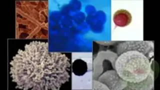 How to Detect Mold in Your Home in Fremont CA