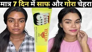 MYFAIR Cream फेयर क्रीम लगाने का सही तरीका | my fair cream review @glamlookbabita 