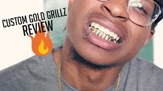 Custom Gold Grillz (Review)
