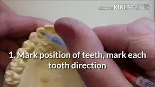 Ortho Spring Retainer lesson #1 of 4 (cutting out teeth)