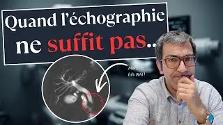 Les Urgences pensaient à des calculs... L'IRM a révélé le PIRE.