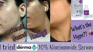 Why Do You Need NIACINAMIDE? MY EXPERIENCE with TheDermaCo 10% Niacinamide Serum for Acne & Scars