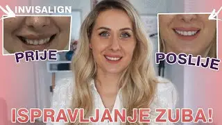 INVISALIGN FOLIJE ZA ISPRAVLJANJE ZUBA - MOJE ISKUSTVO