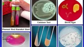Introduction to Microbiology Culture Techniques @biogeny net