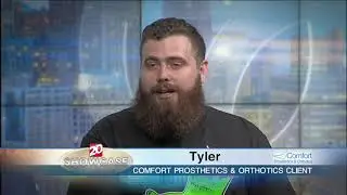 TV20 Showcase featuring Tyler, Patient of Comfort Prosthetics & Orthotics