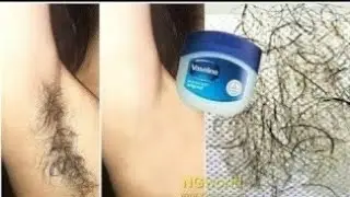 Remove Unwanted Armpit Hair & Bikini Hair Permanently, Unwanted Hair Will Never Grow Back ll NGWorld