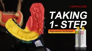 Taking 1 step  Impression technique - Vonflex S [VER2]