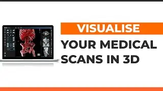 3Dicom for Patient Education - 3D Medical Image Viewer