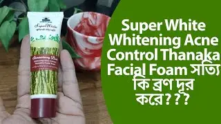 Shwe pyi Nanin Super White whitening Acne face wash review