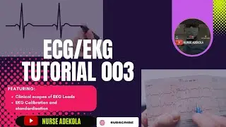 Lecture 3: BASICS OF ECG/EKG.