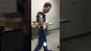 Targeted Muscle Reinnervation Patient