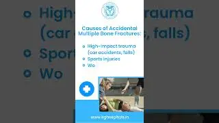 Multiple Bone Fractures: Immediate Care & Treatment Options!