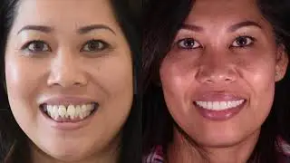 Center For Advanced Dentistry | Smileloc