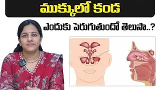 #AskDrHarika || Nasal Polyps Causes, Symptoms & Treatment Options || Dr Harika ENT Care Hospital