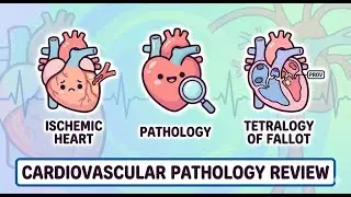 PLE REVIEW 6.5◦ Cardiovascular Pathology