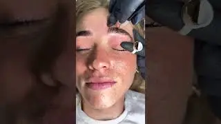 Finally have my dream brows!!! Microblading gave me the perfect shape & definition (with a quick to