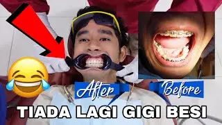 TIADA LAGI GIGI BESI 😢 24 JAM PERGI KLINIK GIGI 😂