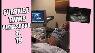 my surprise twins ultrasound - raw reaction