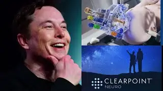 Clearpoint Neuro Stock Review Multibagger?