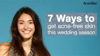 7 ways to get Acne Free Skin this wedding season