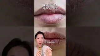 Lip care routine for dry, cracked lips #shorts