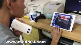 Iphone ipad us venous color doppler scan MSLPU55 device operation