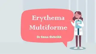 Erythema multiforme part 2