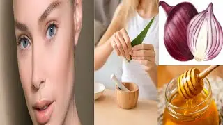 How to use Onion and Honey for face | Remove Acne of Treatment | Home Remedy for Pimples | घरगुती उप