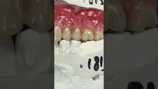 Realistic Tissue Characterization