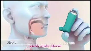 Dose inhaler MDI
