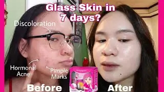 Prestige Rejuvenating Plus Set Review | Glass Skin for only 300 pesos?