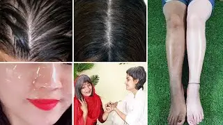 Perfect Skin এবং Healthy Hair এর জন্যে এমন ৫ টি Life Hacks যা প্রত্যেকটি মেয়ের দেখা উচিত
