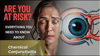 Chemical Conjunctivitis Explained Causes, Symptoms and Treatment, All Insights
