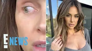 Lala Kent Diagnosed With Pre-Cancerous Eye Growth | E! News